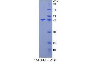 SDS-PAGE analysis of Human CIB1 Protein. (CIB1 蛋白)