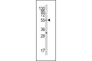 Western blot analysis of anti-TERF1(C-term) Pab (ABIN389240 and ABIN2839387) in Jurkat cell line lysates (35 μg/lane).