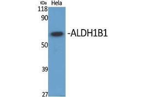 Western Blot (WB) analysis of specific cells using ALDH1B1 Polyclonal Antibody. (ALDH1B1 抗体  (Internal Region))