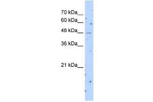 SLC22A23 antibody used at 1 ug/ml to detect target protein.