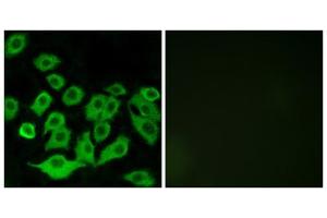 Immunofluorescence analysis of A549 cells, using RPL36 antibody. (RPL36 抗体  (Internal Region))