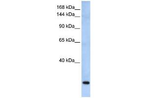 WB Suggested Anti-FBXW10 Antibody Titration: 0. (FBXW10 抗体  (Middle Region))