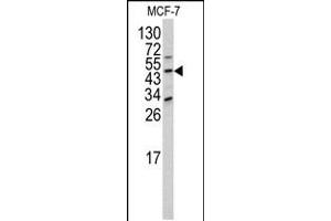 Western blot analysis of DOM3Z antibody (N-term Y88) in MCF-7 cell line lysates (35ug/lane) (DOM3Z 抗体  (N-Term))