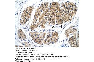 Immunohistochemistry (IHC) image for anti-Nuclear Factor of kappa Light Polypeptide Gene Enhancer in B-Cells 2 (NFKB2) (C-Term) antibody (ABIN2779436)