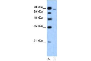 Western Blot showing MLLT4 antibody used at a concentration of 1-2 ug/ml to detect its target protein.