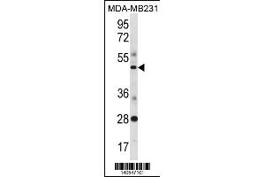 SPIB Antibody (C-term) (ABIN1881823 and ABIN2838428) western blot analysis in MDA-M cell line lysates (35 μg/lane). (SPIB 抗体  (C-Term))