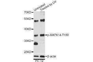 Western blot analysis of extracts of PC-12 cells, using Phospho-MAPK14-T180 antibody (ABIN5969910) at 1/2000 dilution. (MAPK14 抗体  (pThr180))