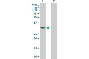 Western Blot analysis of IGFBP2 expression in transfected 293T cell line by IGFBP2 MaxPab polyclonal antibody. (IGFBP2 抗体  (AA 1-328))