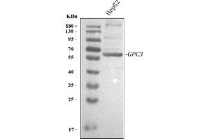 Western blot analysis of Glypican 3/GPC3 using anti-Glypican 3/GPC3 antibody (ABIN7601314).