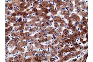 Immunohistochemical staining of paraffin-embedded Human liver tissue using anti-CD80 mouse monoclonal antibody. (CD80 抗体)