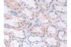 IHC-P analysis of Human Kidney Tissue, with DAB staining. (S100A5 抗体  (AA 1-92))