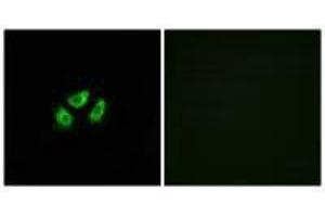 Immunofluorescence analysis of A549 cells, using SCN7A antibody. (SCN7A 抗体)