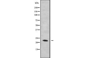 Western blot analysis GAS3 using MDA-MB-435 whole cell lysates (PMP22 抗体  (C-Term))
