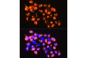 Immunofluorescence analysis of HeLa cells using EPB41L2 antibody (ABIN6131606, ABIN6140199, ABIN6140200 and ABIN6224888) at dilution of 1:100. (EPB41L2 抗体  (AA 1-210))