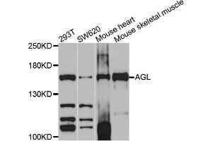 Western blot analysis of extracts of various cells, using AGL antibody. (AGL 抗体)