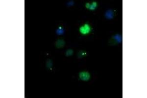 Image no. 1 for anti-Early Growth Response 2 (EGR2) (AA 156-476) antibody (ABIN1490983) (EGR2 抗体  (AA 156-476))