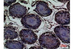 Immunohistochemistry (IHC) image for anti-Ectonucleotide pyrophosphatase/phosphodiesterase 3 (ENPP3) (Internal Region) antibody (ABIN3187797)