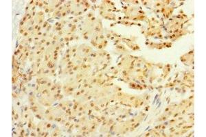 Immunohistochemistry of paraffin-embedded human pancreatic tissue using ABIN7160672 at dilution of 1:100 (GALK2 抗体  (AA 161-458))