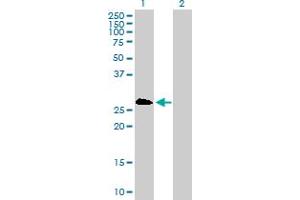 Western Blot analysis of PSMB8 expression in transfected 293T cell line by PSMB8 MaxPab polyclonal antibody. (PSMB8 抗体  (AA 1-272))