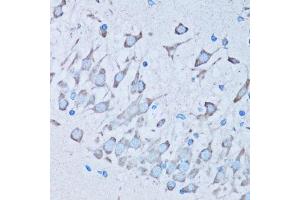 Immunohistochemistry of paraffin-embedded mouse brain using NNMT antibody. (NNMT 抗体  (AA 1-264))