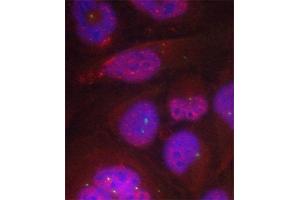 Immunofluorescence (IF) image for anti-Nuclear Factor-kB p65 (NFkBP65) (pSer276) antibody (ABIN1682005) (NF-kB p65 抗体  (pSer276))