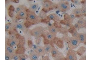 Immunohistochemistry (IHC) image for anti-Protein tyrosine Phosphatase, Receptor Type, H (PTPRH) (AA 844-1096) antibody (ABIN7442888)
