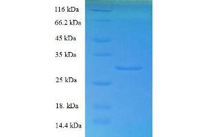 SDS-PAGE (SDS) image for Coactosin-Like Protein (AA 2-142) protein (His-SUMO Tag) (ABIN5711307)