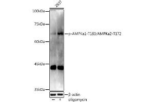 Western blot analysis of extracts of 293T cells, using Phospho-AMPKa1-T183/AMPKa2-T172 antibody (ABIN3020441, ABIN3020442, ABIN3020443 and ABIN1681942) at 1:1000 dilution. (AMPK alpha 抗体  (pThr172))