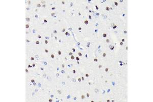 Immunohistochemistry of paraffin-embedded rat brain using BRG1/SM antibody (ABIN7270655) at dilution of 1:100 (40x lens). (SMARCA4 抗体)