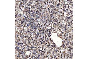 IHC analysis of TOM1L1 using anti-TOM1L1 antibody (ABIN7602631). (TOM1L1 抗体  (AA 9-448))