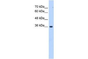 LOC339879 antibody used at 2. (ALG1L6P 抗体  (C-Term))