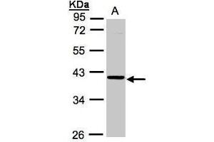 WB Image Sample (30μg whole cell lysate) A:A431, 10% SDS PAGE antibody diluted at 1:1000 (ASB4 抗体)