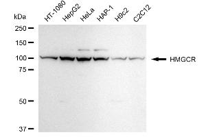 anti-3-Hydroxy-3-Methylglutaryl-CoA Reductase (HMGCR) antibody