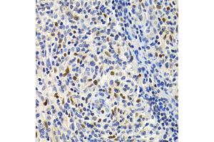 Immunohistochemistry of paraffin-embedded human lymphonodus using GEMIN2 Antibody (ABIN1872798) at dilution of 1:200 (40x lens). (SIP1 抗体)
