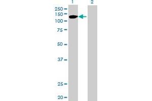 Western Blot analysis of FGFR2 expression in transfected 293T cell line by FGFR2 MaxPab polyclonal antibody. (FGFR2 抗体  (AA 1-821))