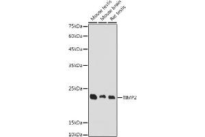Western blot analysis of extracts of various cell lines, using TIMP2 antibody (ABIN7268483) at 1:1000 dilution. (TIMP2 抗体  (AA 100-200))