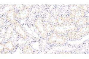 Detection of S100A3 in Human Kidney Tissue using Monoclonal Antibody to S100 Calcium Binding Protein A3 (S100A3) (S100A3 抗体  (AA 1-101))