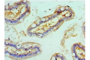 Immunohistochemistry of paraffin-embedded human small intestine tissue using ABIN7168003 at dilution of 1:100 (ROCK2 抗体  (AA 1109-1388))