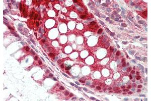 Rabbit Anti-Egln2 antibody  Formalin Fixed Paraffin Embedded Tissue: Human Colon Primary antibody Concentration: 1:100 Secondary Antibody: Donkey anti-Rabbit-Cy3 Secondary Antibody Concentration: 1:200 Magnification: 20x Exposure Time: 0. (PHD1 抗体  (C-Term))
