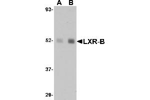 Western blot analysis of LXR-B in human lung tissue lysate with LXR-B antibody at (A) 1 and (B) 2 µg/mL. (NR1H2 抗体  (N-Term))