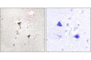 Immunohistochemistry analysis of paraffin-embedded human brain tissue, using PKD1/PKC mu (Ab-205) Antibody. (PKC mu 抗体  (AA 171-220))