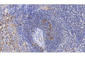 Immunohistochemistry (IHC) image for anti-Ferritin, Heavy Polypeptide 1 (FTH1) (AA 1-183) antibody (ABIN7427582)