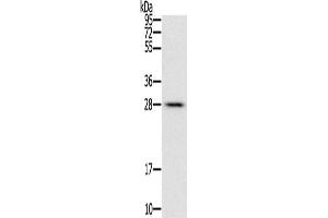 Gel: 12 % SDS-PAGE, Lysate: 40 μg, Lane: Mouse liver tissue, Primary antibody: ABIN7129446(FAM89B Antibody) at dilution 1/400, Secondary antibody: Goat anti rabbit IgG at 1/8000 dilution, Exposure time: 10 seconds (FAM89B 抗体)