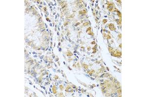 Immunohistochemistry of paraffin-embedded human stomach using RN antibody  at dilution of 1:100 (40x lens). (RNASE13 抗体  (AA 1-156))