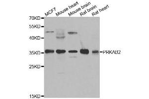 Western blot analysis of extracts of various cell lines, using PRKAB2 antibody. (PRKAB2 抗体  (AA 1-272))