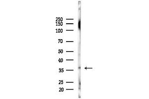 Western blot analysis of lysates from Mouse liver, using PDLIM1 Antibody at 1/1000 dilution.