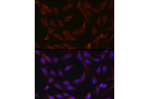 Immunofluorescence analysis of C6 cells using cI Rabbit pAb (ABIN1678920, ABIN3015349, ABIN3015350 and ABIN6213998) at dilution of 1:50 (40x lens). (BIRC3 抗体  (AA 1-180))