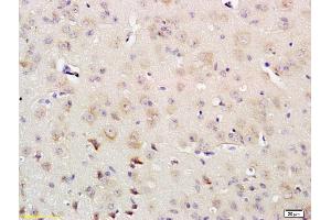 Formalin-fixed and paraffin embedded rat brain labeled with Rabbit Anti IRS-4 Polyclonal Antibody, Unconjugated (ABIN726020) at 1:200 followed by conjugation to the secondary antibody and DAB staining (IRS4 抗体  (AA 401-500))