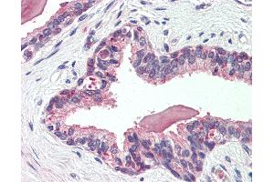 Immunohistochemistry (IHC) image for anti-Solute Carrier Family 12 (Potassium-Chloride Transporter) Member 2 (SLC12A2) (Internal Region) antibody (ABIN1049330)