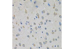 Immunohistochemistry of paraffin-embedded mouse brain using PTK7 antibody. (PTK7 抗体  (AA 811-1070))